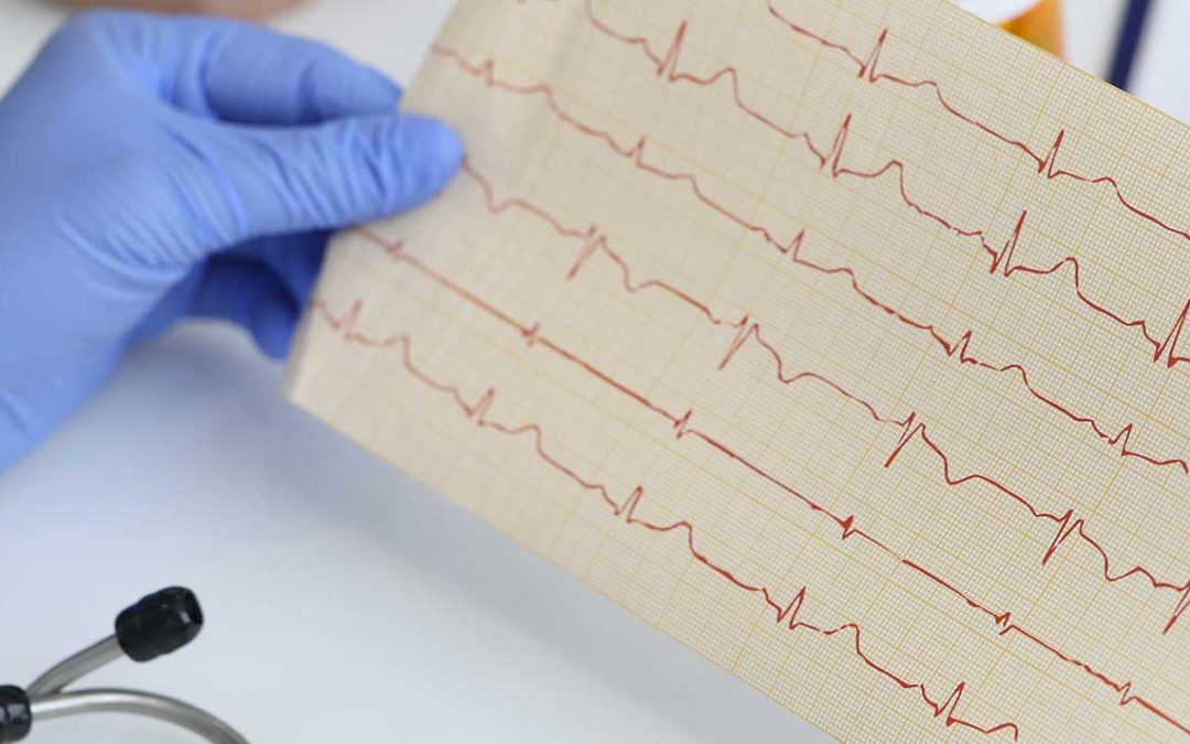 “Acorys” El dispositivo médico para localizar arritmias cardiacas. La vista del corazón desde otra perspectiva.